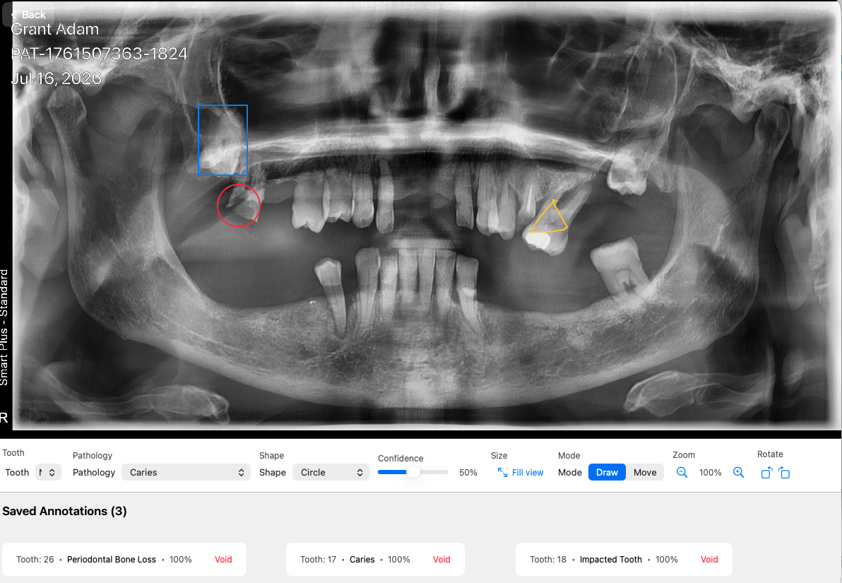 Base Dental clinical AI module showing radiographic pathology detection